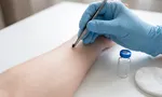 Как вытащить клеща у человека и что делать после укуса